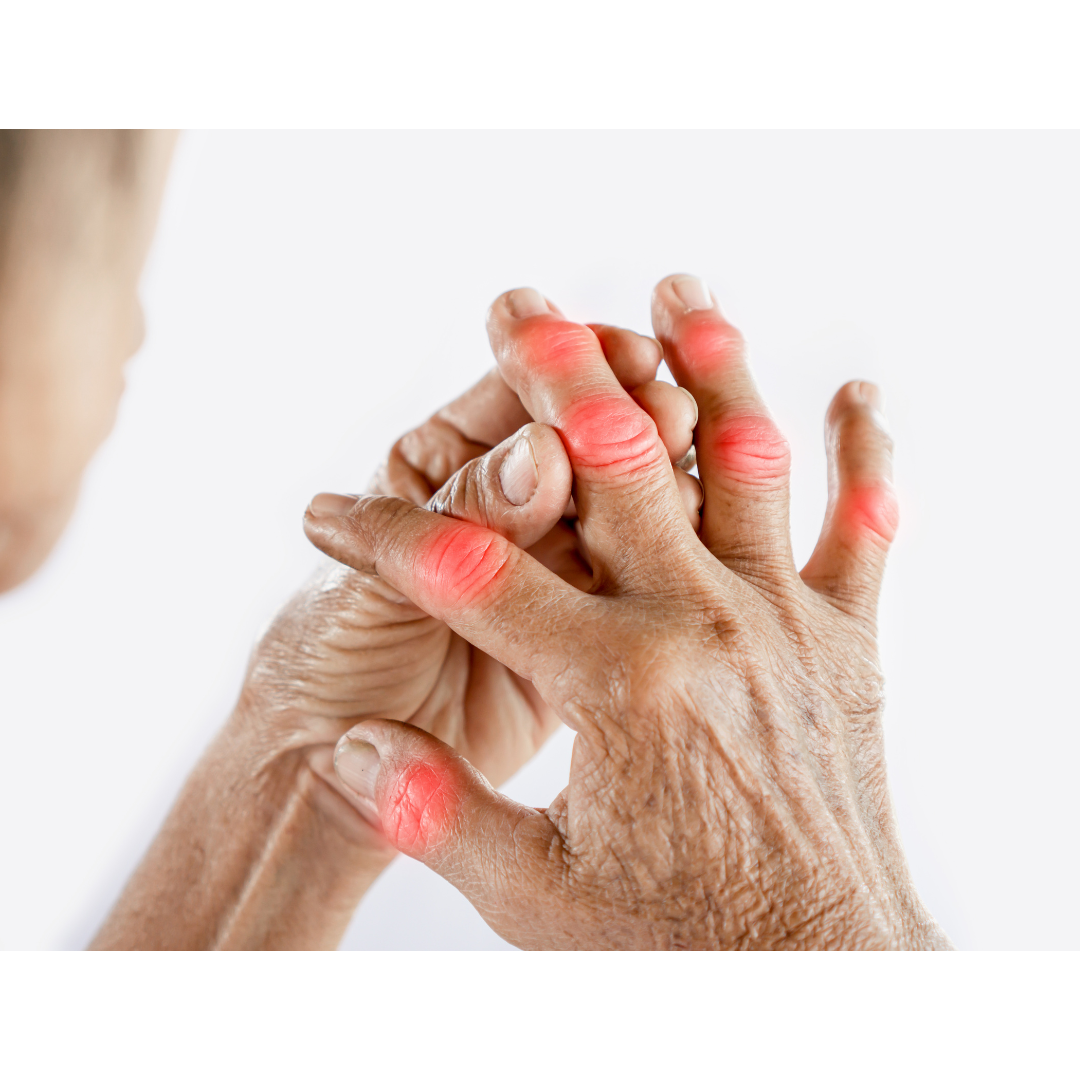Joint pain